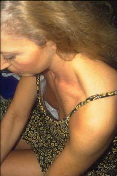 downblouse